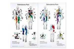 Sclerotome Pain Charts 22 X 36&quot Set Of 2